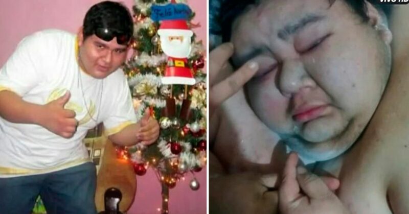 Joven con 300 kilos de sobrepeso necesita ayuda para atenderse: "Le dio  depresión cuando su mamá falleció" - ATV