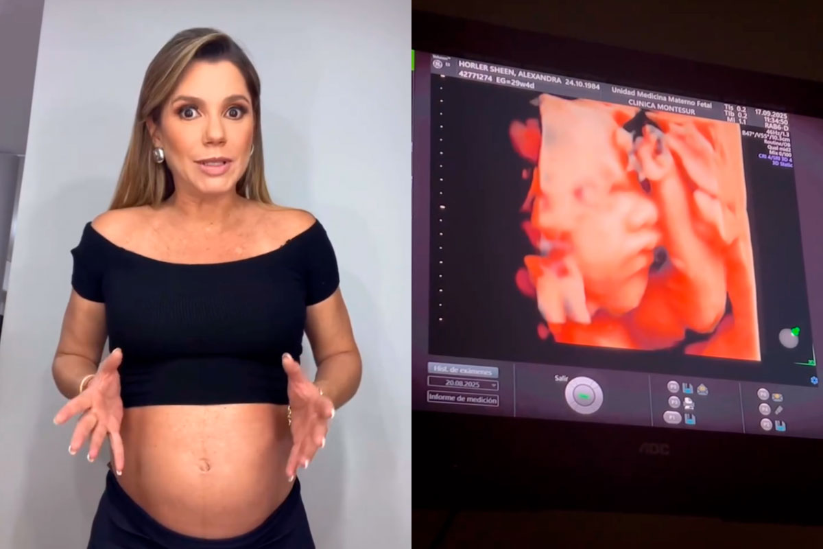 Alexandra Hörler se quiebra al revelar complicación en su embarazo: “No ha sido fácil de asimilar”