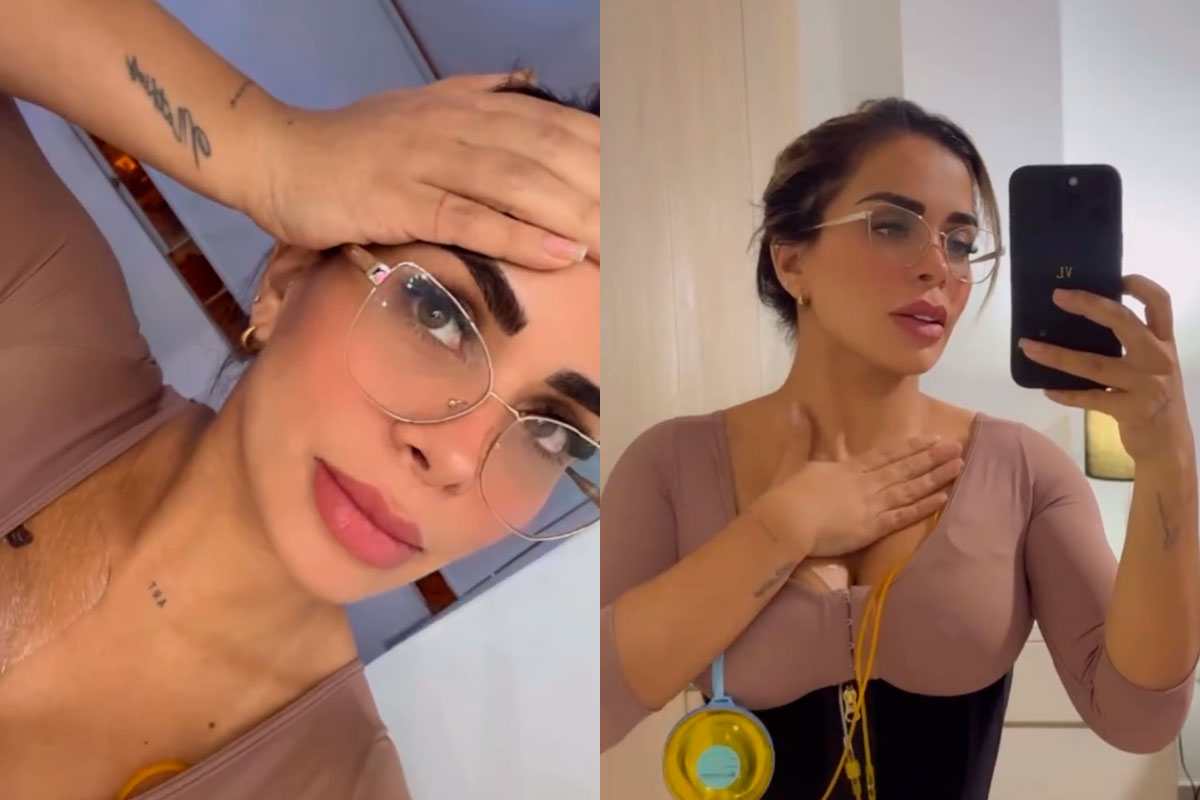 Vanessa López impacta al revelar que se hizo la lipo y luxación de costillas a la vez: “Sentí que no podía ni caminar”