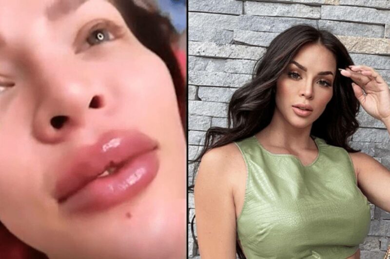 Sheyla Rojas se arrepiente de sus 'retoquitos' y jura que se quitará todo:  "Me he puesto tanto" - ATV