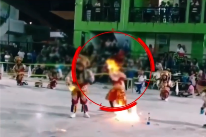Escolar sufre graves quemaduras en el rostro durante danza de tijeras en su colegio