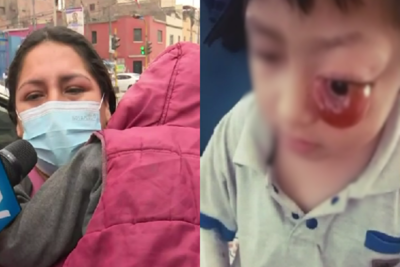 Derek tiene un enorme tumor en el ojo y lucha por sobrevivir: su familia pide ayuda urgente